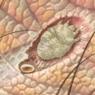 scabies si kutu busuk yang susah sembuh dan gejala beserta pengobatannya